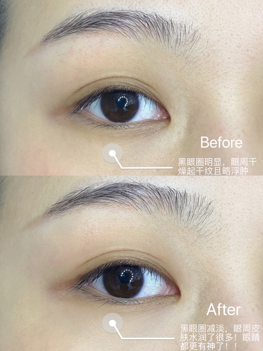 眼霜—Kerrykerry宝贝收到了，刚用肌肤嘟噜嘟噜的喝水，用完之后脸明显变白了，很喜欢